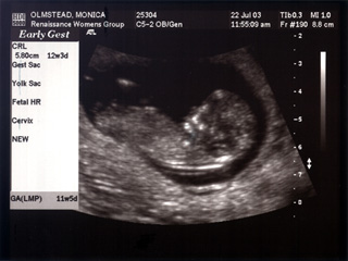 Baby Mojo